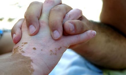 El vitiligo y las emociones