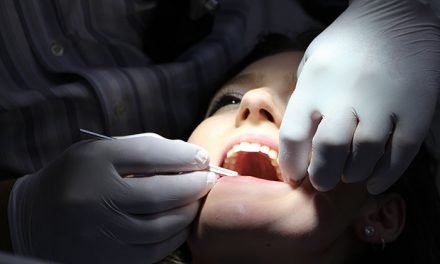 Abscesos dentales y la salud bucal