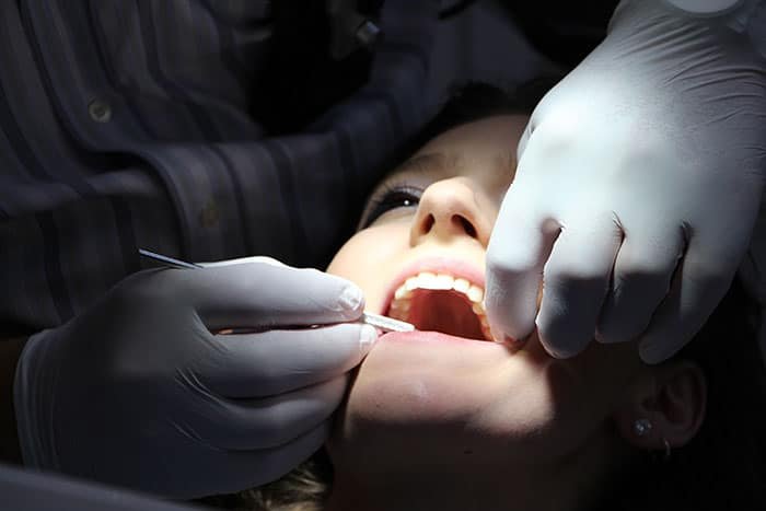 Abscesos dentales y la salud bucal